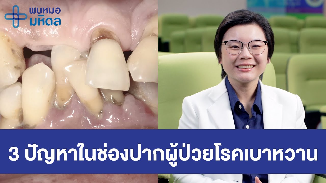 3 ปัญหาในช่องปากผู้ป่วยโรคเบาหวาน | พบหมอมหิดล