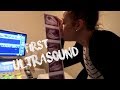 Top Secret Ultrasound