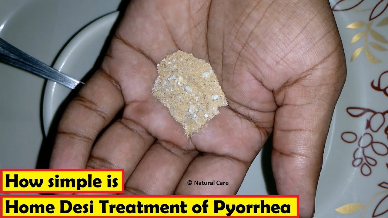 workout exercise ball How simple is Home Desi Treatment of Pyorrhea