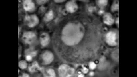 Asymmetric mitosis of a neuroblast in Drosophila