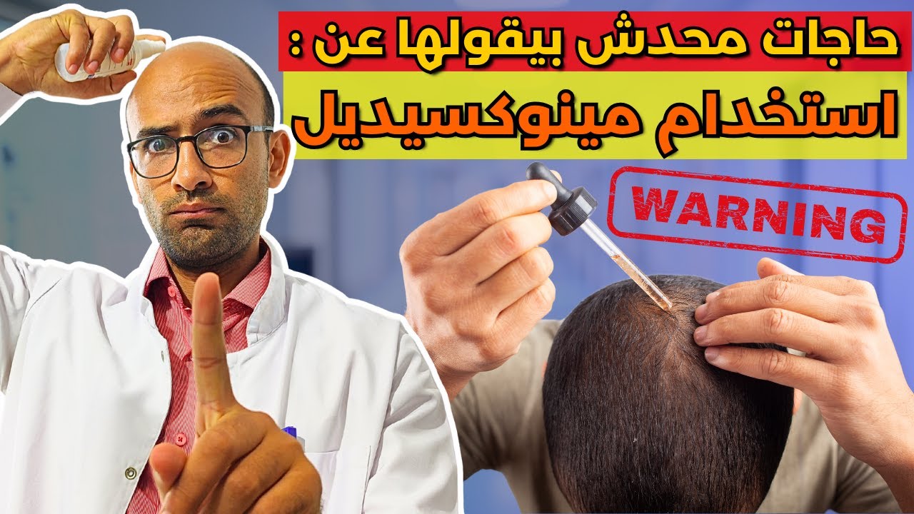 اشهر 7 اخطاء في استعمال مينوكسيديل بتقلل من نتايجه - و تزود اعراضه الجانبية (شاهد قبل الاستخدام)