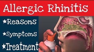 How To Unblock Your Sinuses | Allergies Rhinitis - Reasons and Remedies For Treatment