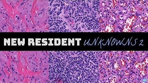 NEW RESIDENT UNKNOWNS 2 | 3 Interesting Cases +  Beginner