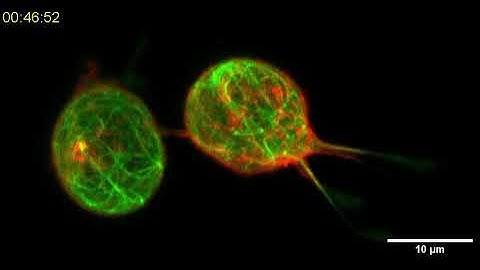 Changes in cell surface excess are coordinated with protrusion dynamics during 3D motility