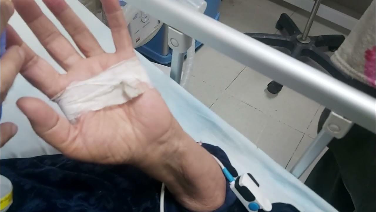 Asterixis patient with type 2 respiratory failure clinical skills