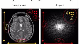 BE280A19 MRI Lecture 5