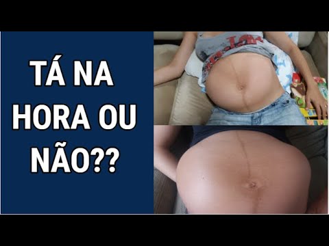 Vídeo: Diferença Entre Braxton Hicks E Contração Do Trabalho