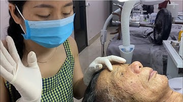 Latest acne treatment for 93 year old gentleman 2024 part 2
