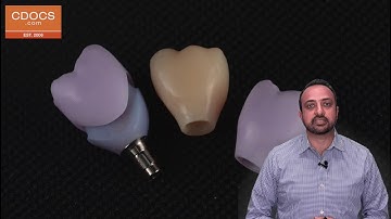 Tip of the Day: What is a Ti-Base?