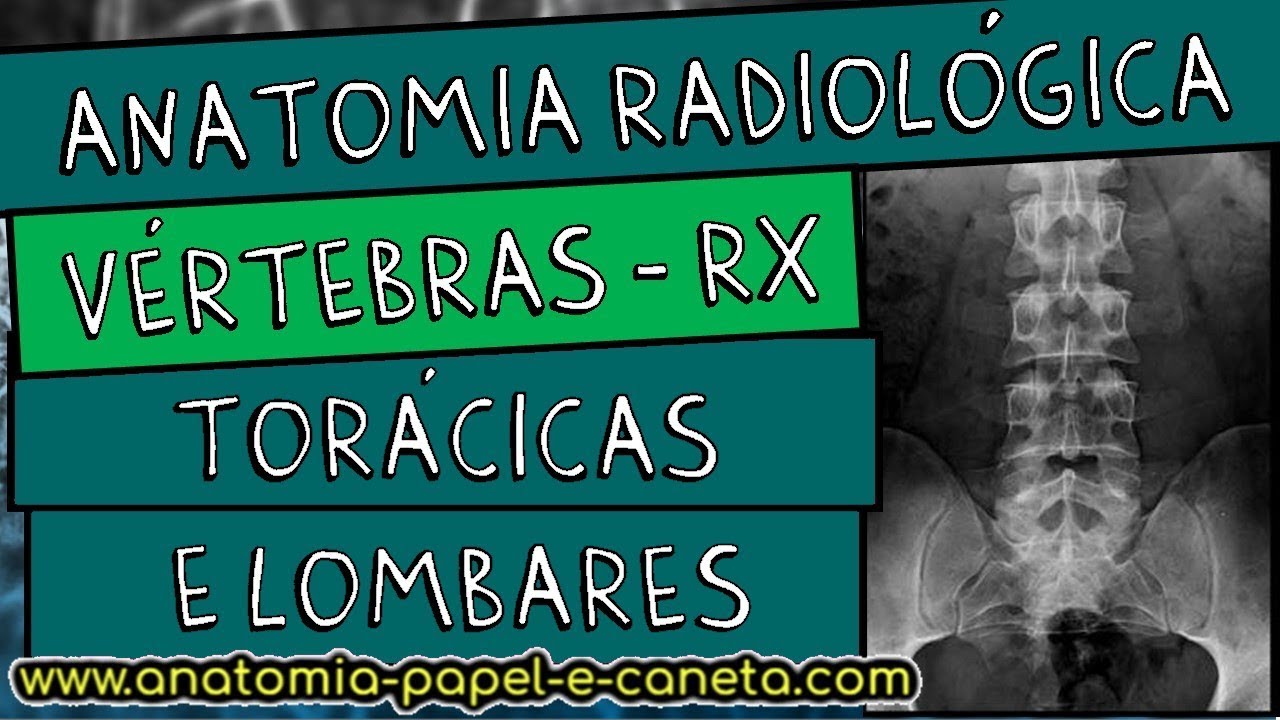 Anatomia radiológica (RX) da coluna vertebral - TORÁCICA E LOMBAR - Sinal  do CÃO ESCOCÊS 