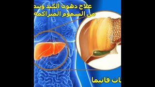 علاج دهون الكبد وتنظيفه من السموم المتراكمة نهائيا-وصفة تخلصك من الدهون والسموم المتراكمة من سنوات