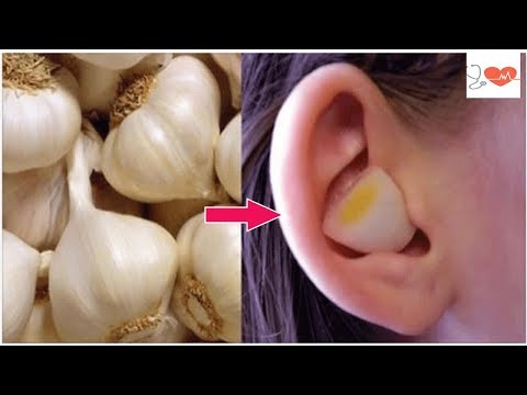 Wideo: Czosnek W Uchu: Korzyści I Zagrożenia Dla Uszu