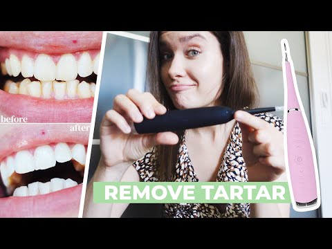 HOW TO REMOVE CALCULUS TARTAR PLAQUE AT HOME | Ultrasonic Tooth Cleaner Review 2021 - Does It Work?