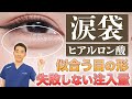 【人気なプチ整形】涙袋のヒアルロン酸について徹底解説