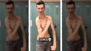 "He Finally Started Bulking..." - YouTube