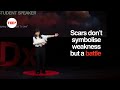 Signing My Contract to Live | Wen Bao | TEDxUniversity of Sydney
