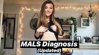 MALS Diagnosis & Post Surgery (Updated)