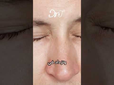 ما هي حساسية العين صحة    