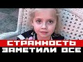 Отклонение у Лизы Галкиной: чем старше, тем заметнее