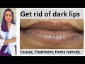 How to get rid of dark lips | Lighten dark lips|home remedy for dark lips |Dermatolgist| Dr. Aanchal