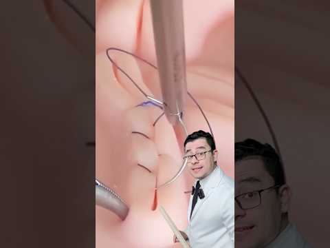 افضل كريم للجروح والحروق