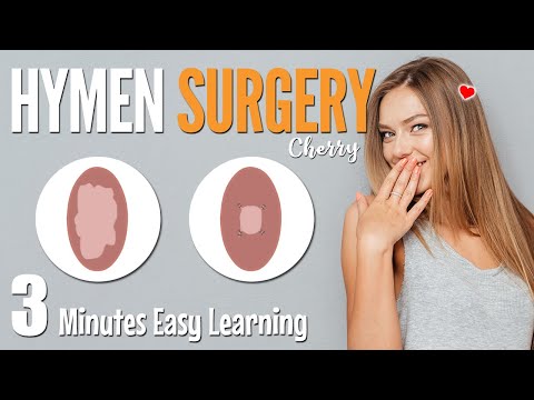 Video: Rekonstruktion Av Hymen Med Hymenoplasty