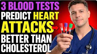 3 Blood Tests That Predict Heart Attacks Better Than Cholesterol   Cardiologist Explains 3 Blood Tests That Predict Heart Attacks Better Than Cholesterol Most Doctors Miss This