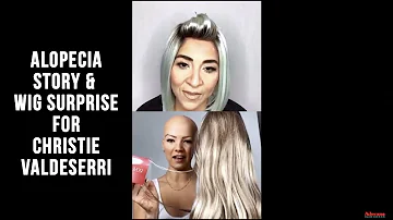 Christie Valdiserri’s Alopecia Journey & Wig Surprise