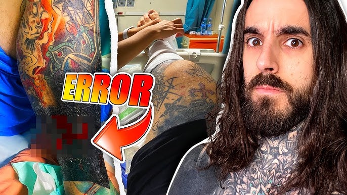 Cómo curar un tatuaje infectado? 5 consejos - Blogs MAPFRE