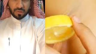 مخاطر إستخدام الليمون الحامض🍋على الإبطين لتفتيحها(دكتور طلال المحيسن) وأفضل طرق ازالة شعر الابطين👍