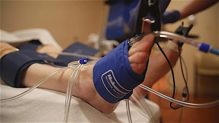 Dr. Gaston Dana: What is Chronic Venous Insufficie...