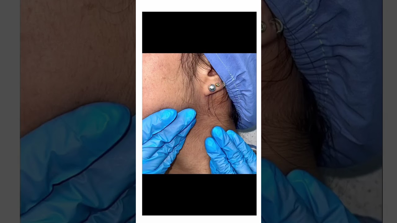 Autoexamen bucal 🙌🏻👄