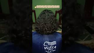 كيفيه علاج الشعر الهايش والمقصف hair haircare