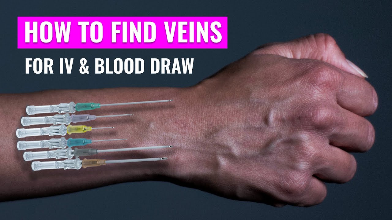 How To Find Difficult Veins