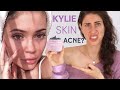 KylieSkin's Acne Collection - Medical Esthe Breaks Down & Reviews The Clarifying Collection