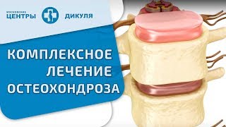 Остеохондроз. Вопрос-ответ.