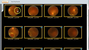 Mosaicing with i2k Retina