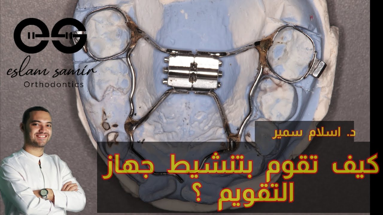 كيف تقوم بتنشيط جهاز التقويم في المنزل #مركز_اسنان_دكتور_اسلام_سمير #تقويم_اسنان #تجميل