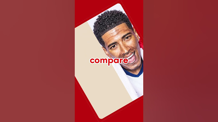 Jaw-Dropping White Teeth Challenge in Football Players😱