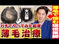 【薄毛で悩む男性必見！】薄毛で悩む現役医師がガチでAGA治療してみた