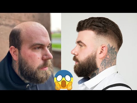 BEFORE & AFTER | Men's Hair system Transformation | BLIND REACTION - BEN