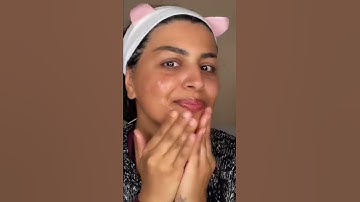 SLUGGING 🐌🤮 WHAT? #shorts #shortsvideo