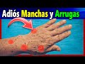 Quita las arrugas y manchas de las manos solo aplica 1 de estos 3 remedios caseros