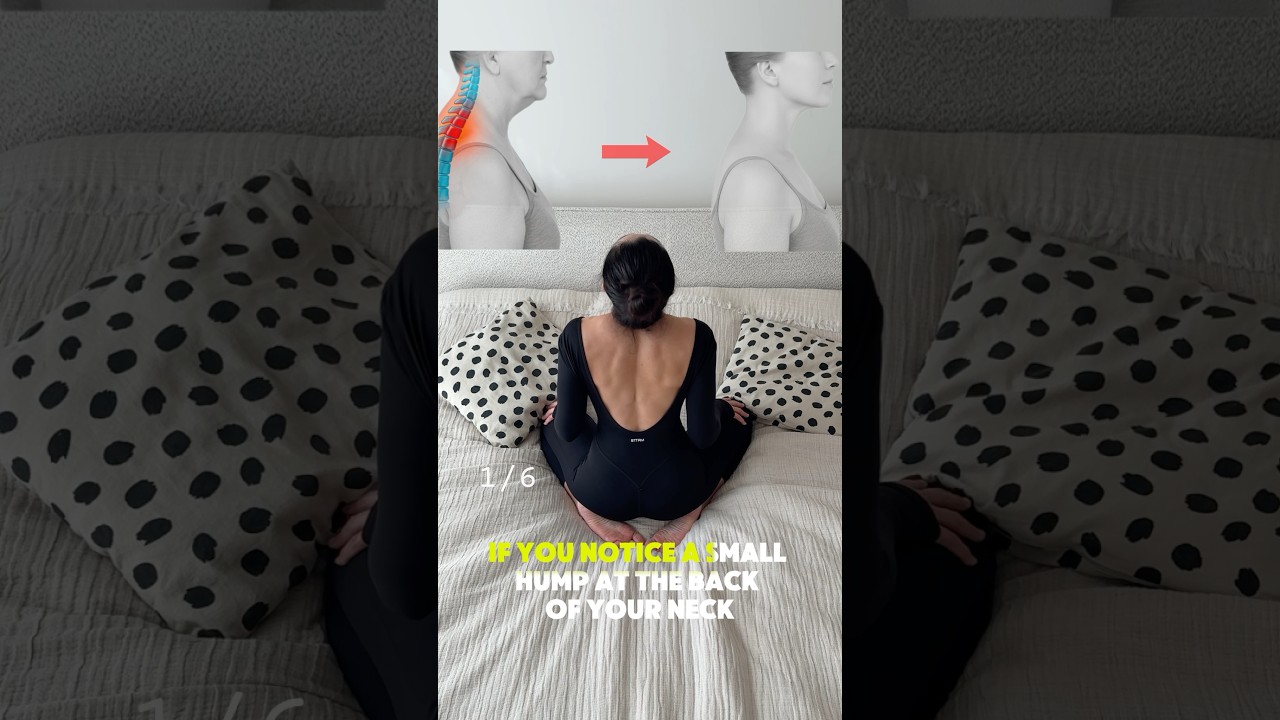 How to reduce neck hump 
