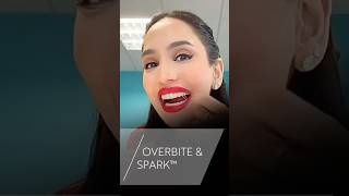 Famous How @Amenakhan corrects her overbite with Spark™ Clear Aligners 🪢 Profile