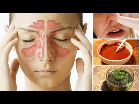 8 Ways To Clear A Stuffy Nose Naturally