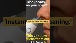 “Blackheads gone in seconds. This suction tool cleans pores instantly.”