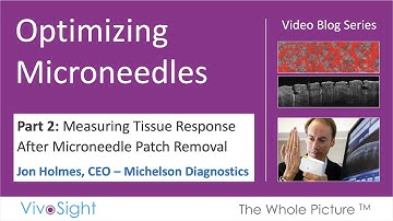 Optimization of Microneedle Array Patches (MAPs) Part 2: Measuring Tissue Response After MAP Removal