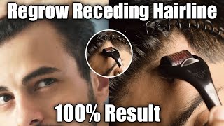 Regrow Hairline || How To Regrow Receding Hairline || Dermaroller ||Hairline Regrowth || Regrow Hair