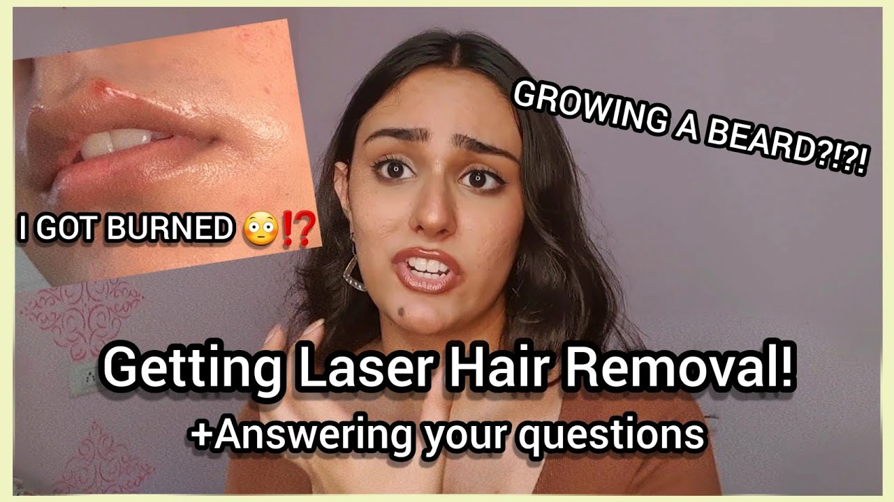Getting Laser Hair Removal I GOT BURNED Trans Talk YouTube